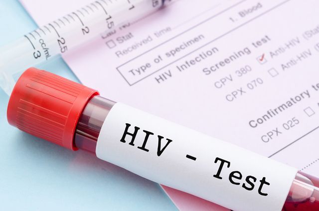 Более 1,5 тыс. случаев ВИЧ-инфекции зафиксировано в Беларуси с начала года